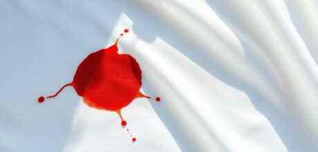 Como Tirar Manchas Difíceis: Dicas Infalíveis e Práticas